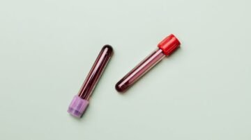 MPV w morfologii – co oznacza i kiedy warto się niepokoić?