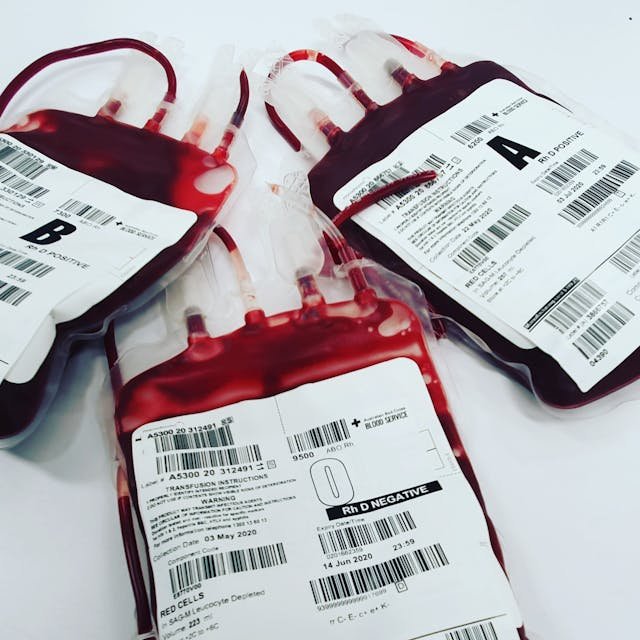 Hemoglobina – co mówi o zdrowiu i kiedy warto ją zbadać?