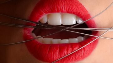 Afty – przyczyny, objawy i leczenie zmian w jamie ustnej