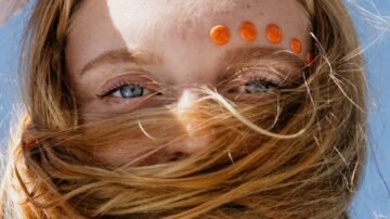 Guz na głowie lub czole – jak udzielić pierwszej pomocy po uderzeniu